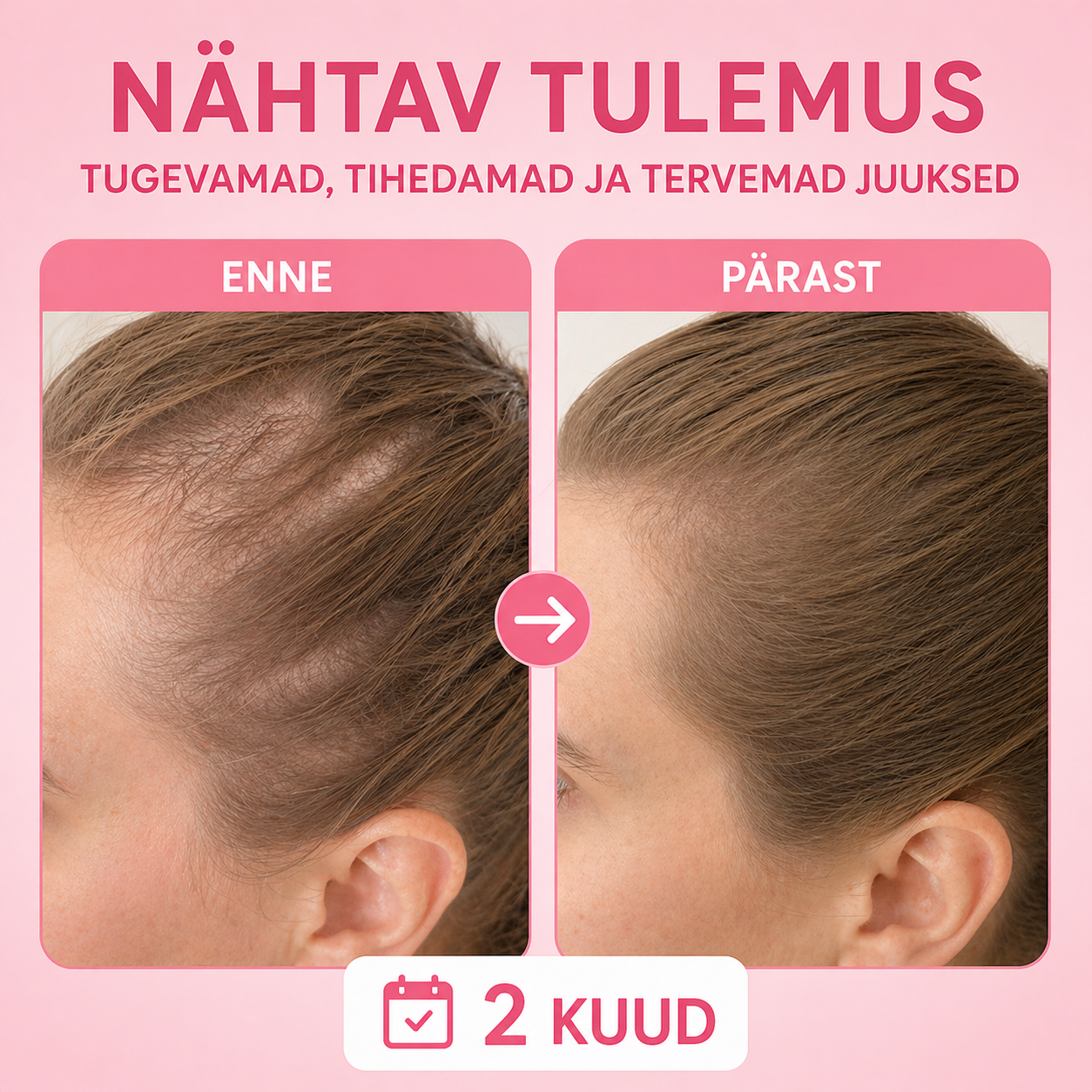 Toeta tugevamaid ja paksemaid juukseid seestpoolt